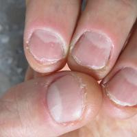 Why does a child bite his nails - all the reasons